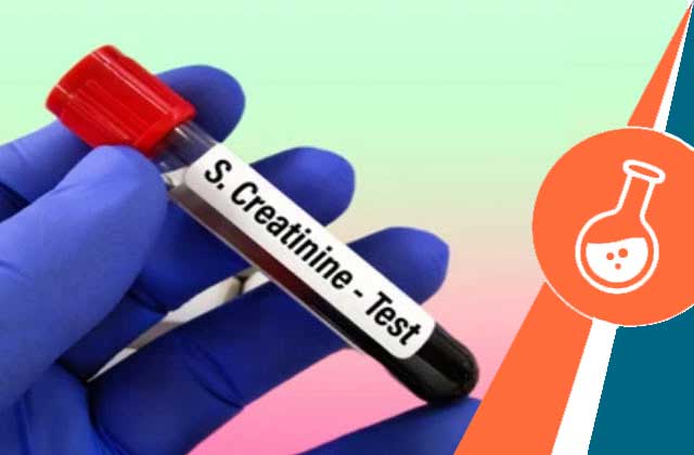 S.creatinine Test Price In Bangladesh