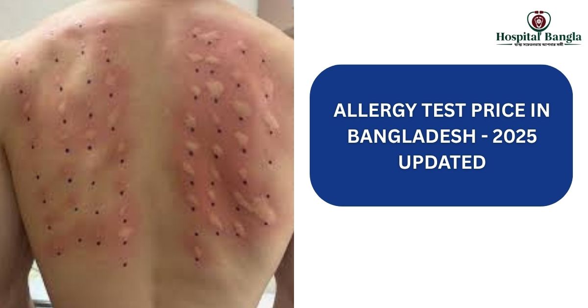 Allergy Test Price in Bangladesh