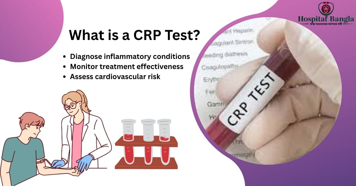 CRP Test Price in Bangladesh