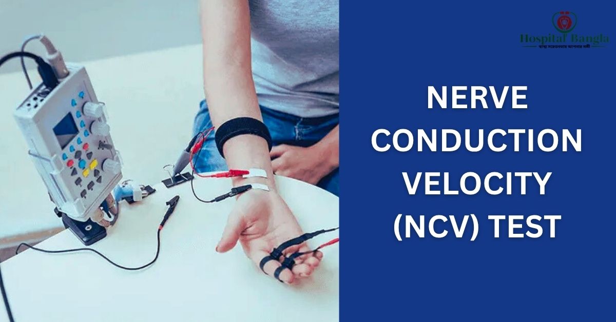 NCV Test Price in Bangladesh