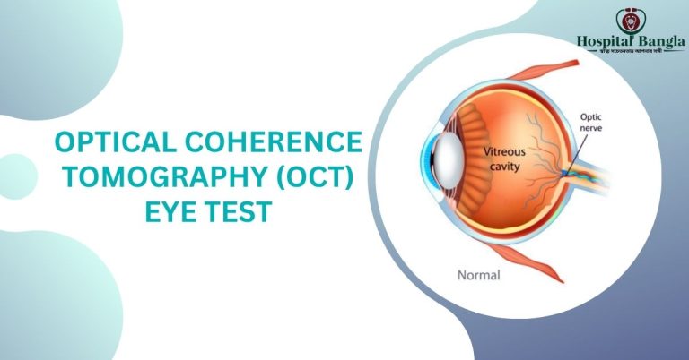 OCT Eye Test Price in Bangladesh