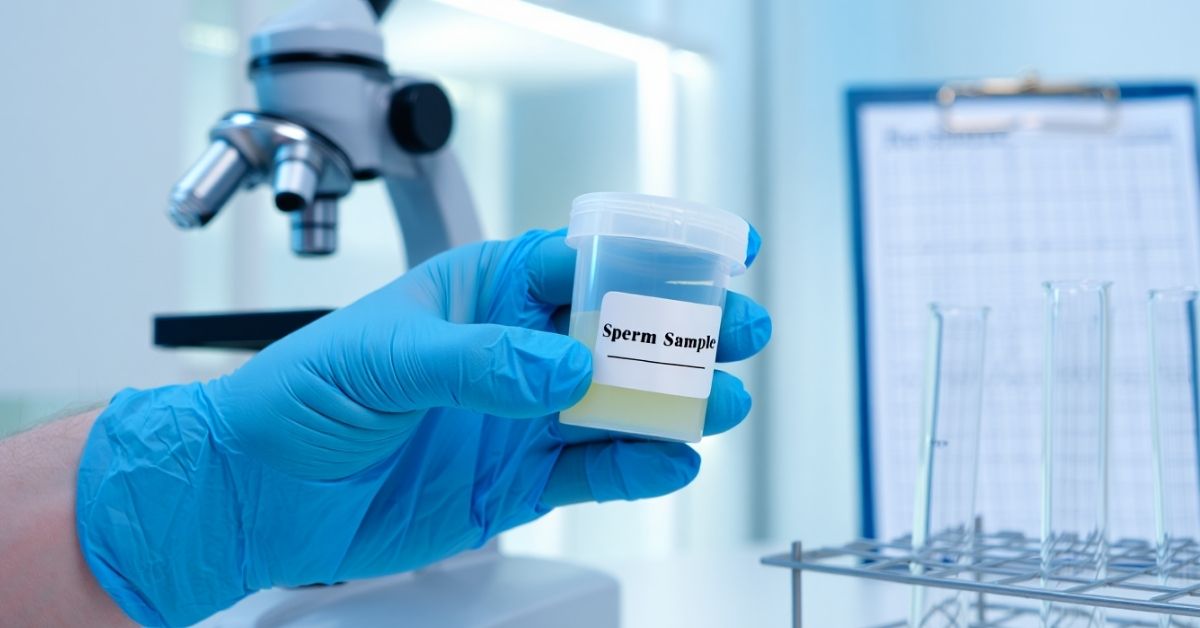 Sperm Test Price In Bangladesh