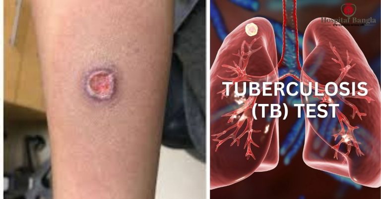 TB Test Price in Bangladesh