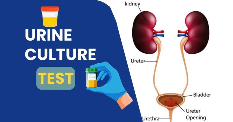 Urine Culture Test Price in Bangladesh