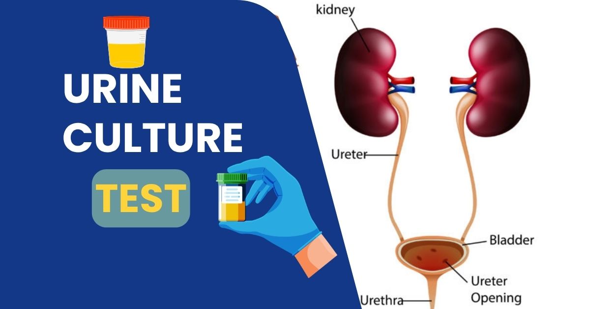 Urine Culture Test Price in Bangladesh